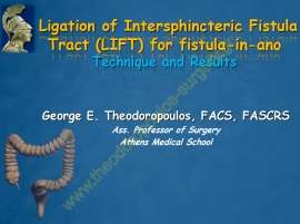 Περιεδρικά συρίγγια - LIFT